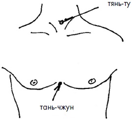 Иллюстрация к книге — 700 китайских упражнений для лечения и предотвращения 100 болезней [Autogen_eBook_id189.jpg]