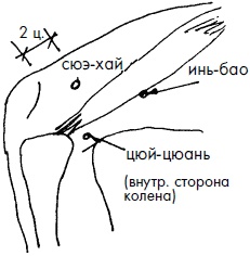 Иллюстрация к книге — 700 китайских упражнений для лечения и предотвращения 100 болезней [Autogen_eBook_id204.jpg]