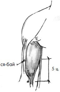 Иллюстрация к книге — 700 китайских упражнений для лечения и предотвращения 100 болезней [Autogen_eBook_id91.jpg]