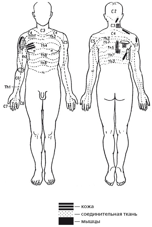 Иллюстрация к книге — Исцеляющие методики массажа. Комплексный подход [i_123.jpg]