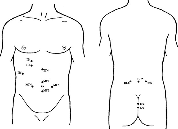 Иллюстрация к книге — Лечение пиявками. Теория и практика гирудотерапии [i_030.jpg]
