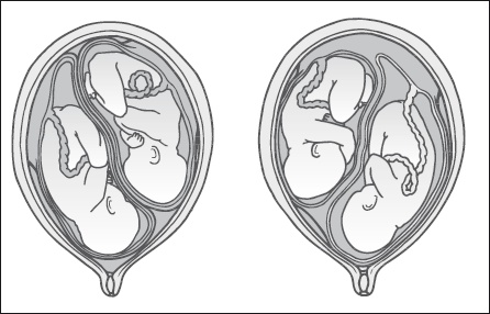 Иллюстрация к книге — Главная российская книга мамы. Беременность. Роды. Первые годы [i_066.jpg]