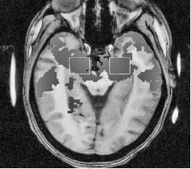 Иллюстрация к книге — Флипноз. Искусство мгновенного убеждения [i_005.jpg]