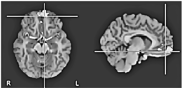 Иллюстрация к книге — Флипноз. Искусство мгновенного убеждения [i_052.jpg]