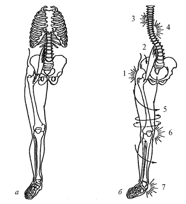 Иллюстрация к книге — Плоскостопие. Легкая походка - здоровый позвоночник [Autogen_eBook_id3.jpg]
