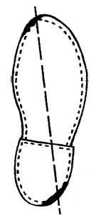 Иллюстрация к книге — Плоскостопие. Легкая походка - здоровый позвоночник [Autogen_eBook_id5.jpg]