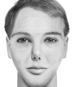 Иллюстрация к книге — Комплексная визуальная диагностика [i_036.jpg]