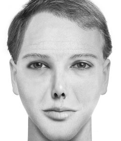 Иллюстрация к книге — Комплексная визуальная диагностика [i_083.jpg]