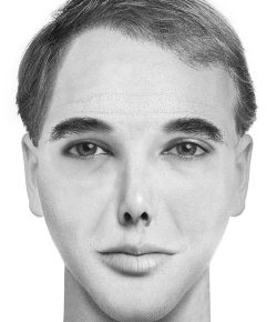 Иллюстрация к книге — Комплексная визуальная диагностика [i_093.jpg]