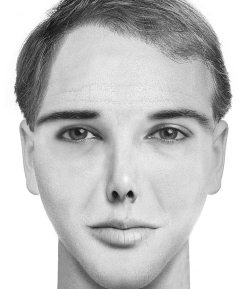 Иллюстрация к книге — Комплексная визуальная диагностика [i_107.jpg]