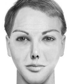 Иллюстрация к книге — Комплексная визуальная диагностика [i_121.jpg]