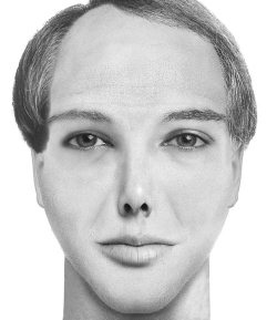 Иллюстрация к книге — Комплексная визуальная диагностика [i_291.jpg]