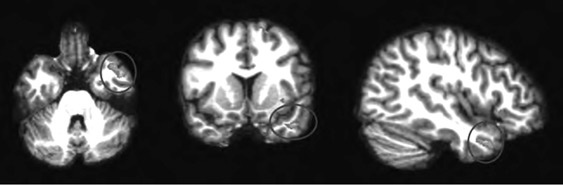 Иллюстрация к книге — Внимательный мозг. Научный взгляд на медитацию [i_014.jpg]