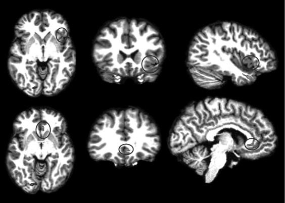 Иллюстрация к книге — Внимательный мозг. Научный взгляд на медитацию [i_015.jpg]