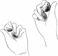 Иллюстрация к книге — От сомнений к определенности. Опыт врача [i_018.jpg]