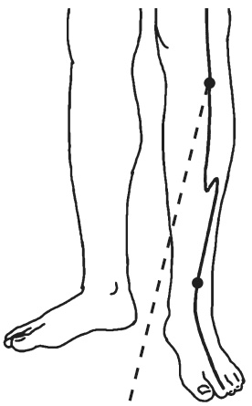 Иллюстрация к книге — Лучшие шаманские практики выздоровления [i_036.jpg]