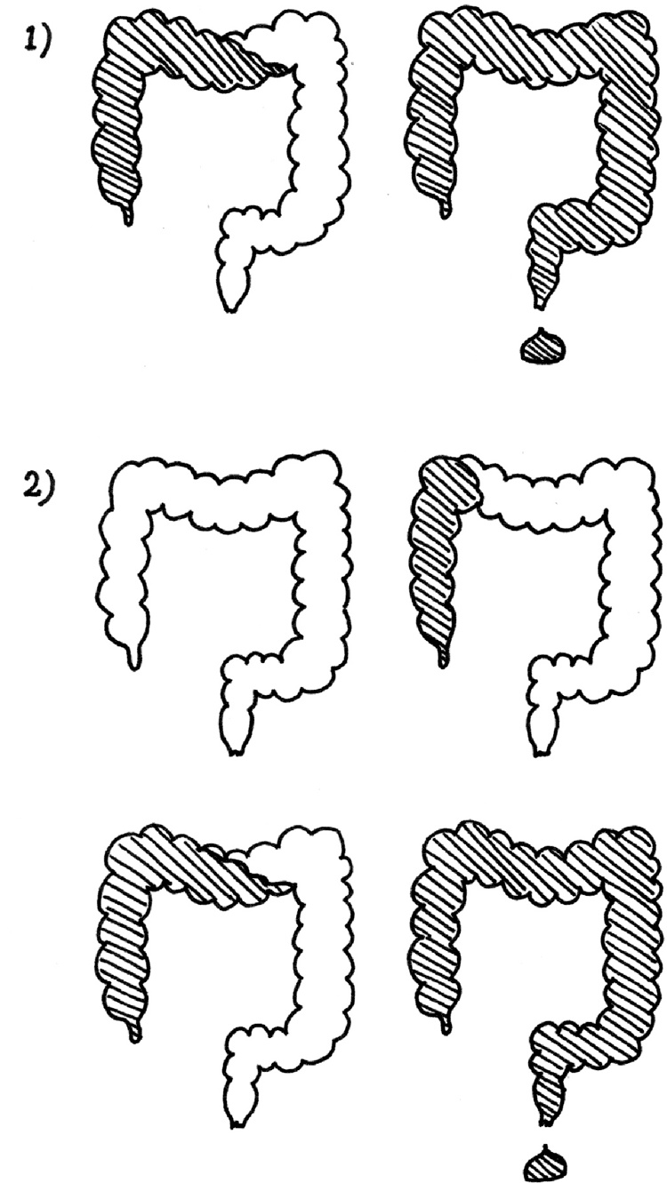 Иллюстрация к книге — Очаровательный кишечник. Как самый могущественный орган управляет нами [i_018.jpg]