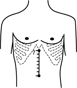 Иллюстрация к книге — Как снять очки за 10 занятий без операции [_059.jpg]