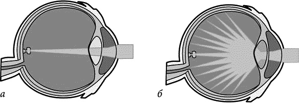 Иллюстрация к книге — Как снять очки за 10 занятий без операции [_076.jpg]