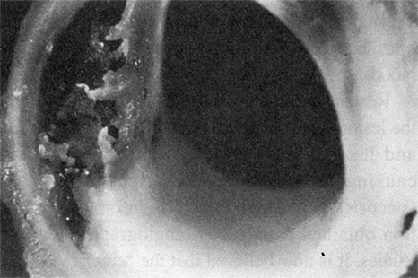 Иллюстрация к книге — Здоровое сердце. Издание XXI века [i_010.jpg]