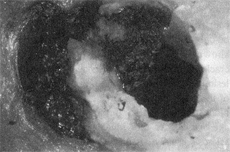 Иллюстрация к книге — Здоровое сердце. Издание XXI века [i_011.jpg]