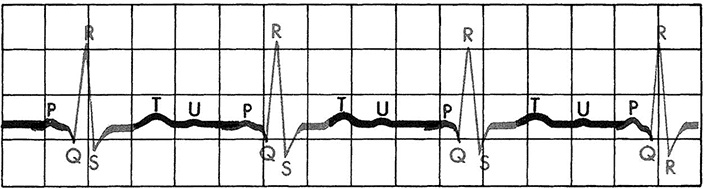Иллюстрация к книге — Здоровое сердце. Издание XXI века [i_021.jpg]