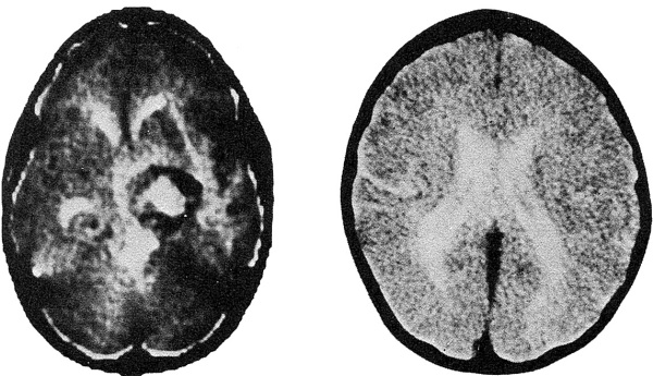 Иллюстрация к книге — Я выбираю жизнь. Целительная сила человеческого духа [i_011.jpg]