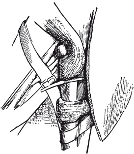 Иллюстрация к книге — Меч в век рыцарства. Классификация, типология, описание [i_040.jpg]