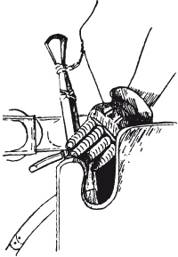 Иллюстрация к книге — Археология оружия. От бронзового века до эпохи Ренессанса [i_156.jpg]