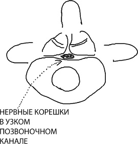 Иллюстрация к книге — Большая книга упражнений для спины. Комплекс &quot;Умный позвоночник&quot; [_11.jpg]