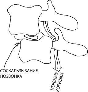 Иллюстрация к книге — Большая книга упражнений для спины. Комплекс &quot;Умный позвоночник&quot; [_13.jpg]