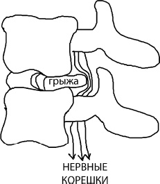 Иллюстрация к книге — Большая книга упражнений для спины. Комплекс &quot;Умный позвоночник&quot; [_7.jpg]