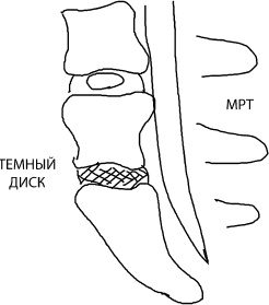 Иллюстрация к книге — Большая книга упражнений для спины. Комплекс &quot;Умный позвоночник&quot; [_8.jpg]