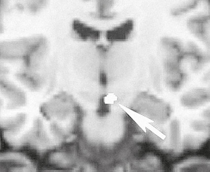 Иллюстрация к книге — Век самопознания. Поиски бессознательного в искусстве и науке с начала XX века до наших дней [i_104.jpg]
