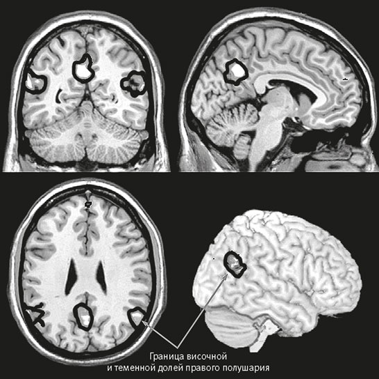 Иллюстрация к книге — Век самопознания. Поиски бессознательного в искусстве и науке с начала XX века до наших дней [i_113.jpg]