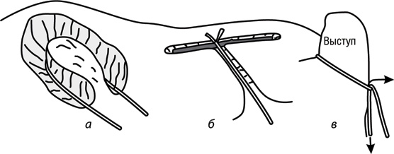 Иллюстрация к книге — Учебник по выживанию в экстремальных ситуациях [i_080.jpg]