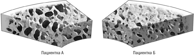 Иллюстрация к книге — Йога при остеопорозе [_10.jpg]