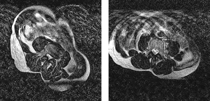 Иллюстрация к книге — Йога при остеопорозе [_261.jpg]