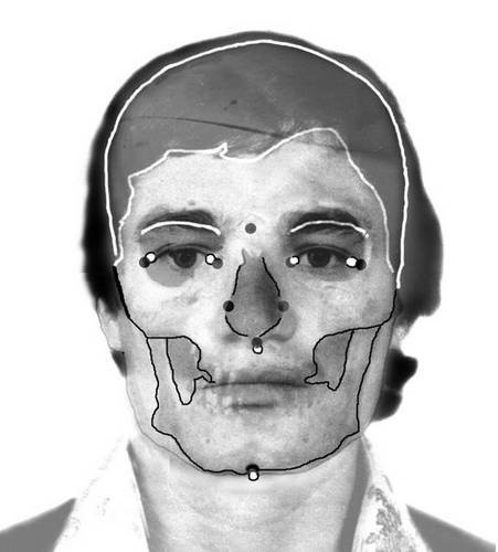 Иллюстрация к книге — Откровения судебного медика [i_018.jpg]
