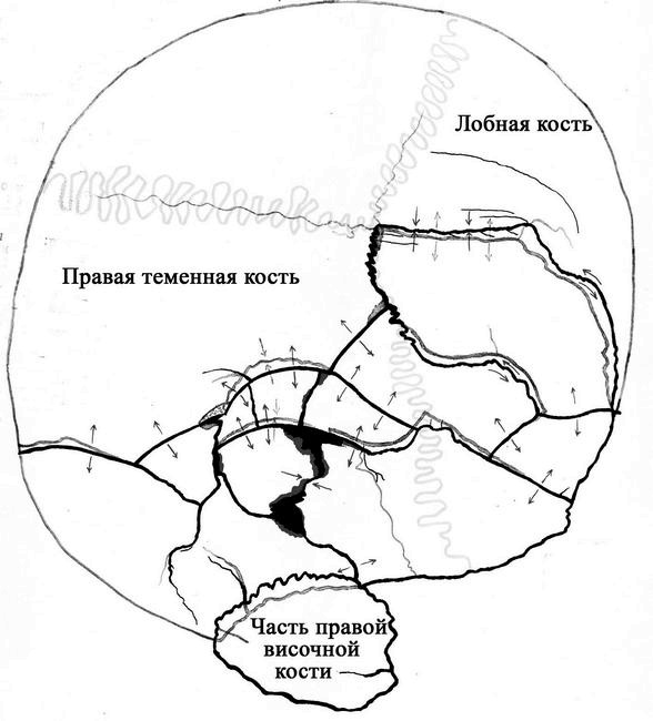 Иллюстрация к книге — Откровения судебного медика [i_030.jpg]