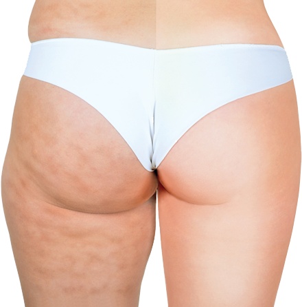 Иллюстрация к книге — Я тебя похудею [i_015.jpg]