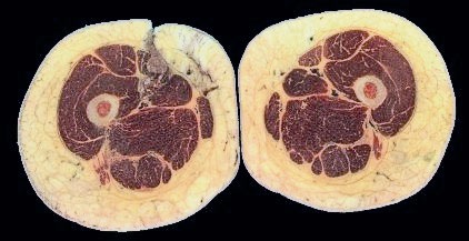 Иллюстрация к книге — Я тоже была толстой [i_006.jpg]