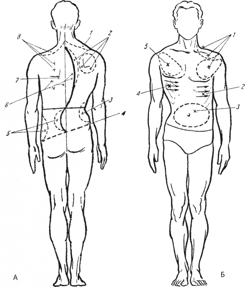 Иллюстрация к книге — Атлас. Практический массаж [i_154.jpg]