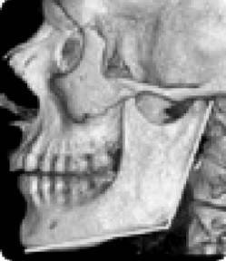 Иллюстрация к книге — Биогимнастика для лица: система фейсмионика [i_013.jpg]