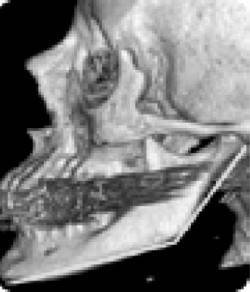 Иллюстрация к книге — Биогимнастика для лица: система фейсмионика [i_014.jpg]