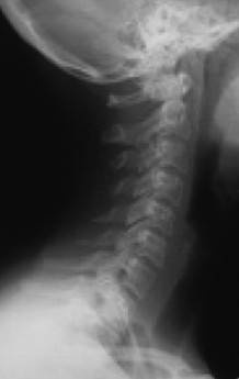 Иллюстрация к книге — Биогимнастика для лица: система фейсмионика [i_017.jpg]