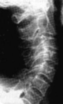 Иллюстрация к книге — Биогимнастика для лица: система фейсмионика [i_019.jpg]