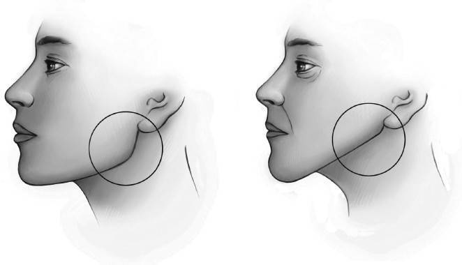 Иллюстрация к книге — Биогимнастика для лица: система фейсмионика [i_026.jpg]