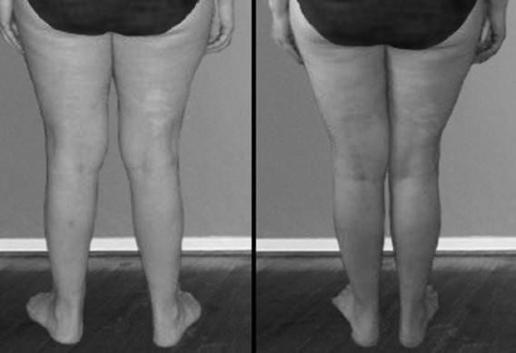 Иллюстрация к книге — Биогимнастика для лица: система фейсмионика [i_079.jpg]