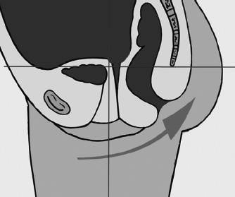 Иллюстрация к книге — Биогимнастика для лица: система фейсмионика [i_082.jpg]